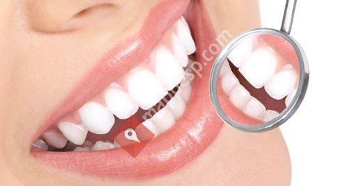 Centro Dental Avanzado Blanqueamiento Dental