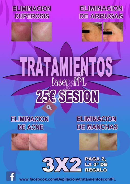 Depilacion y Tratamientos IPL